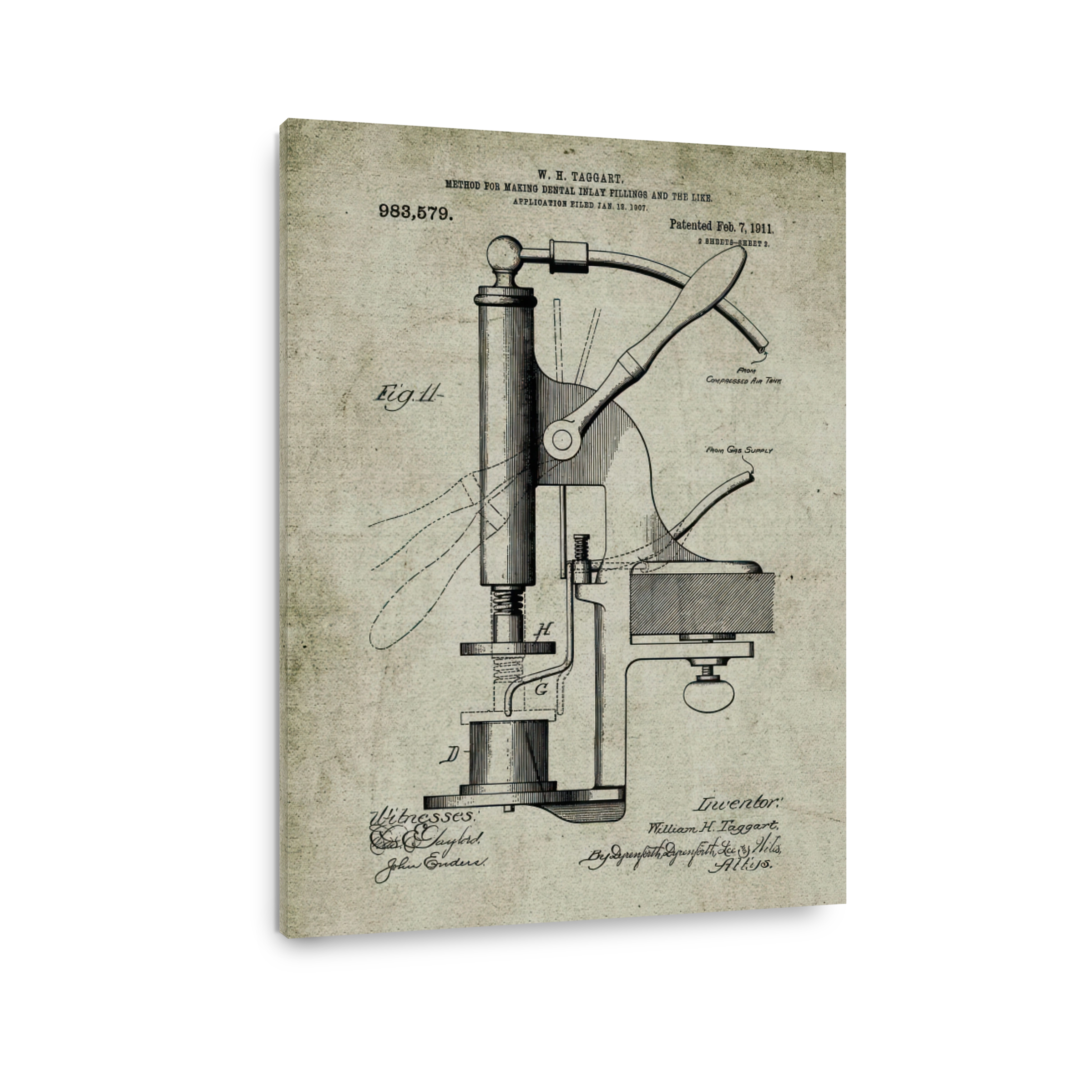 Vintage Dental Inlay Filling Machine Blueprint